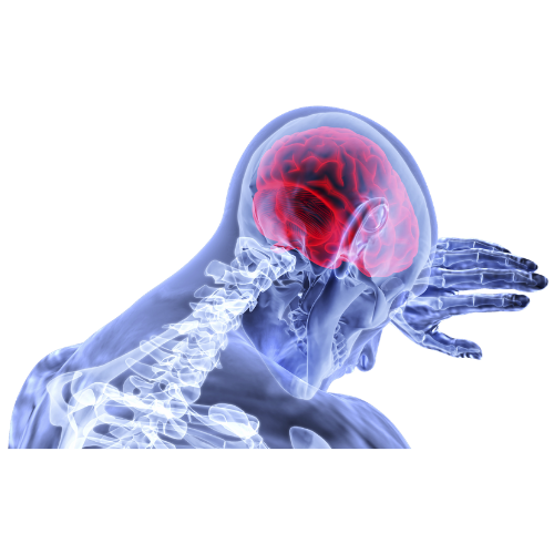 Brain injury Lawyers Gold Coast