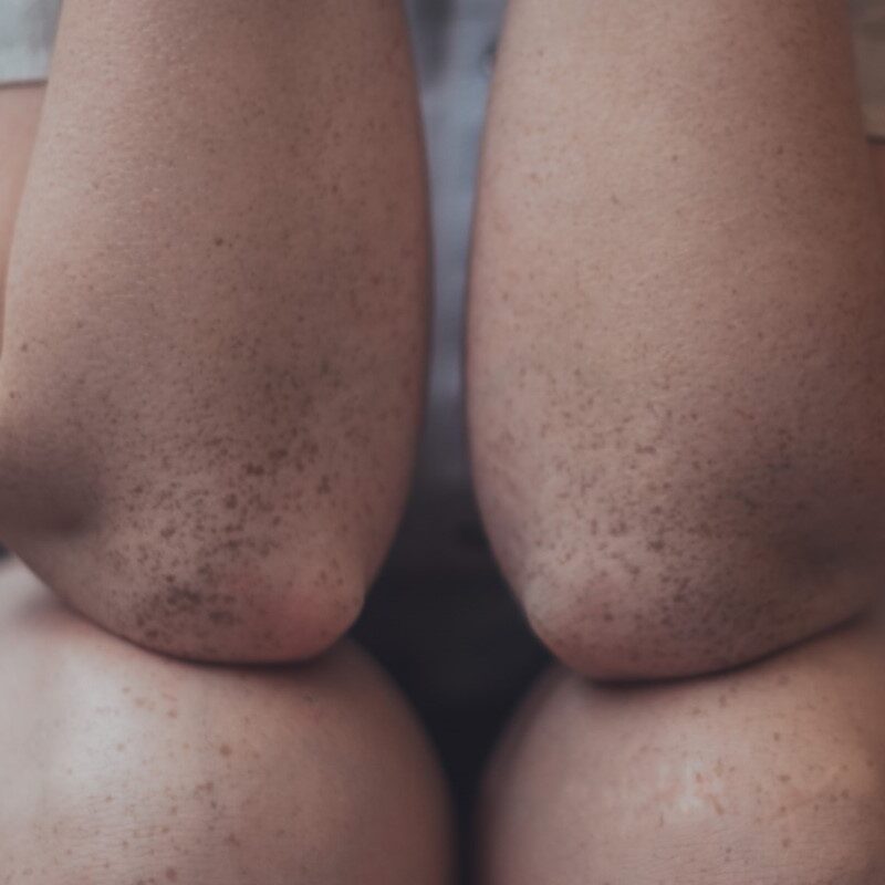 Close up shot of someone's elbows